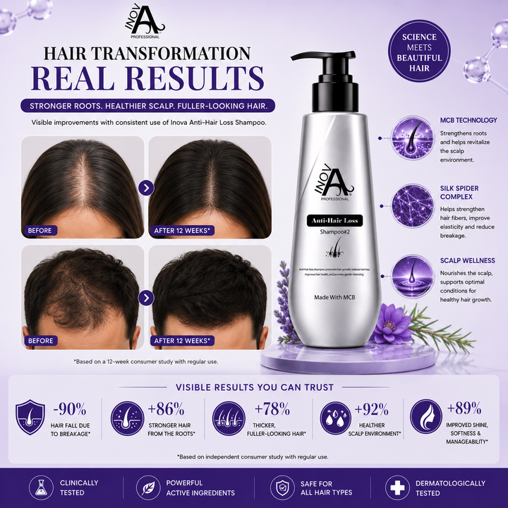 Inova Professional Anti-Hair Loss Shampoo Step #2 hair transformation results image showing visible improvement in hair density, scalp coverage, stronger roots, reduced hair fall due to breakage, fuller-looking hair, healthier scalp appearance, and thicker healthier-looking hair with continued use of the Root Renew system.